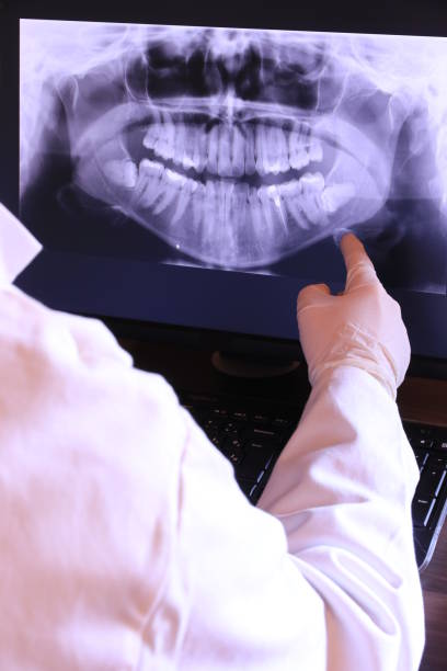 Best Emergency Treatment for Dental Infections or Abscesses in Shakopee, MN